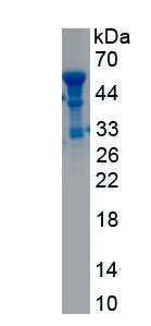 Recombinant Integrin Alpha M (CD11b)