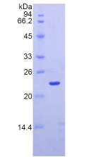 Recombinant Integrin Alpha M (CD11b)