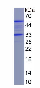 Recombinant Myogenic Differentiation (MyoD)