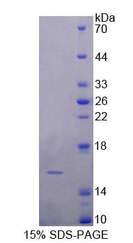 Recombinant Fatty Acid Binding Protein 4 (FABP4)