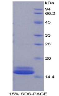 Recombinant Fatty Acid Binding Protein 4 (FABP4)