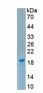 Recombinant Fatty Acid Binding Protein 4 (FABP4)