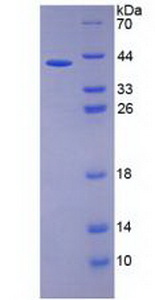 Recombinant Interleukin 26 (IL26)