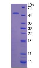 Recombinant Alpha-1-Antitrypsin (a1AT)