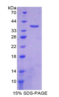 Recombinant Lactate Dehydrogenase B (LDHB)