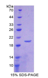 Recombinant Lipocalin 1 (LCN1)