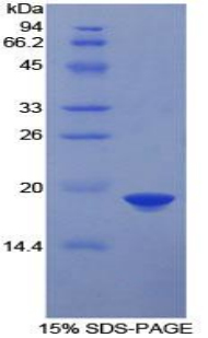 Recombinant Farnesyl Diphosphate Farnesyltransferase 1 (FDFT1)