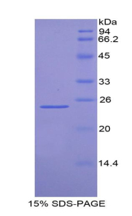 Recombinant Farnesyl Diphosphate Farnesyltransferase 1 (FDFT1)