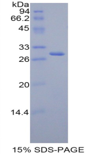 Recombinant Farnesyl Diphosphate Farnesyltransferase 1 (FDFT1)