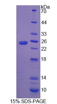 Recombinant Rh Associated Glycoprotein (RHAG)