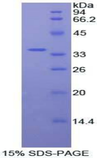 Recombinant Protein Kinase B Beta (PKBb)