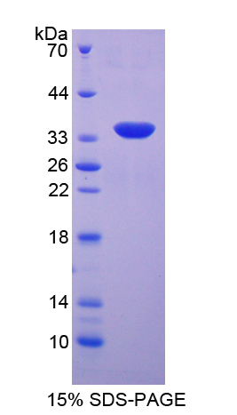 Recombinant Serum/Glucocorticoid Regulated Kinase 2 (SGK2)