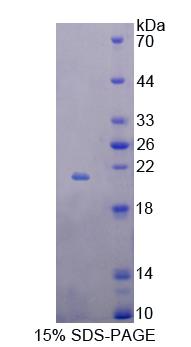 Recombinant B And T-Lymphocyte Attenuator (BTLA)