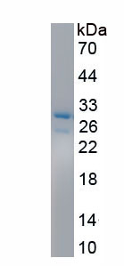 Recombinant Pyridoxal Kinase (PDXK)
