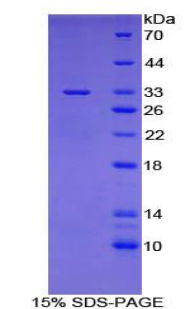 Recombinant Pyridoxal Kinase (PDXK)