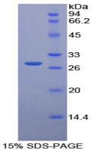 Recombinant Pyridoxal Kinase (PDXK)