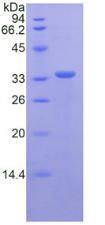 Recombinant Cluster Of Differentiation (CD163)