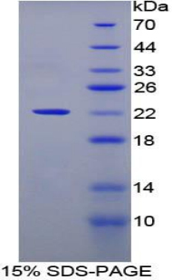 Recombinant Cluster Of differentiation 299 (C<b>D299</b>)