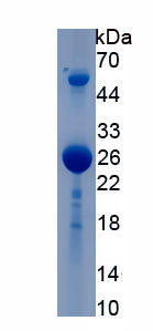 Recombinant Signal Transducer And Activator Of Transcription 3 (STAT3)