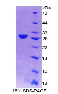 Recombinant Phosphofructokinase, Platelet (PFKP)