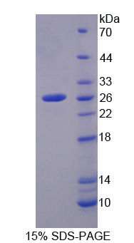 Recombinant Phosphofructokinase, Platelet (PFKP)