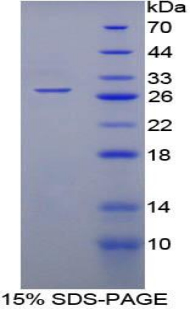 Recombinant Tryptophanyl tRNA Synthetase (WARS)