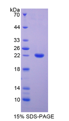 Recombinant EGF Like Module Containing Mucin Like Hormone Receptor 2 (EMR2)