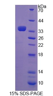 Recombinant Transglutaminase 3, Epidermal (TGM3)