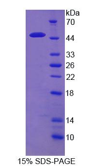 Recombinant Regenerating Islet Derived Protein 1 Alpha (REG1a)