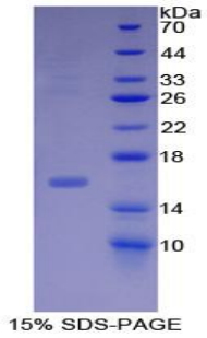 Recombinant Inhibin Beta B (INHbB)