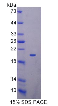 Recombinant Killer Cell Lectin Like Receptor Subfamily K, Member 1 (KLRK1)