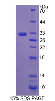 Recombinant Prostaglandin F2 Receptor Negative Regulator (PTGFRN)