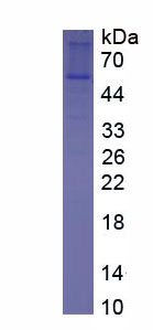 Recombinant Transglutaminase 1 (TGM1)