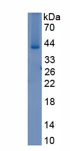 Recombinant Transglutaminase 1 (TGM1)