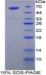 Recombinant Transglutaminase 1 (TGM1)