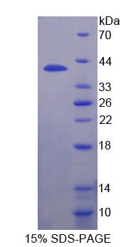 Recombinant Interferon Regulatory Factor 8 (IRF8)