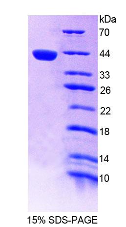 Recombinant Interferon Regulatory Factor 8 (IRF8)