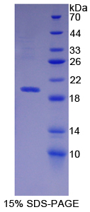 Recombinant Neprilysin (CD10)