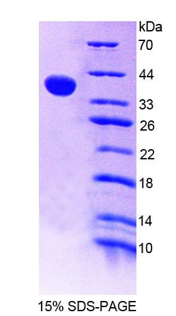 Recombinant Receptor Interacting Serine Threonine Kinase 2 (RIPK2)