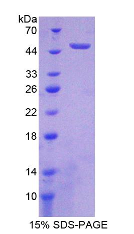 Recombinant Fibroblast Growth Factor Receptor 1 (FGFR1)