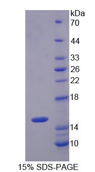 Recombinant S100 Calcium Binding Protein A8 (S100A8)