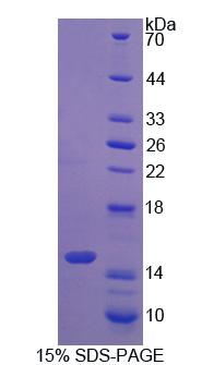 Recombinant S100 Calcium Binding Protein A9 (S100A9)