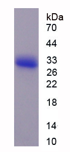 Recombinant Fibroblast Growth Factor Receptor 2 (FGFR2)