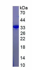 Recombinant Fibroblast Growth Factor Receptor 2 (FGFR2)