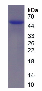 Recombinant High Molecular Weight Kininogen (HMWK)