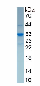 Recombinant Selenoprotein P1, Plasma (SEPP1)