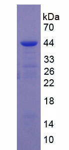 Recombinant Vitamin D Binding Protein (DBP)