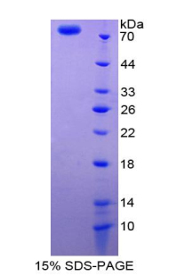 Recombinant Vitamin D Binding Protein (DBP)