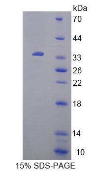 Recombinant Uridine Phosphorylase 1 (UPP1)