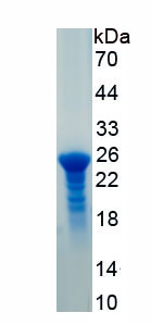 Recombinant Interleukin 6 Receptor (IL6R)